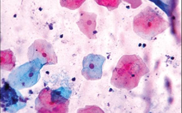 Η ΖΩΗ ΜΕΤΑ ΤΟ ASCUS