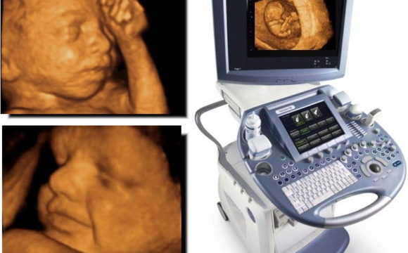 3D/ 4D Scan