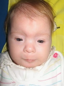 FASD