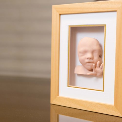 3D FETAL PRINTING