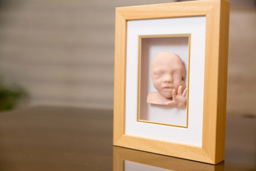 3D FETAL PRINTING