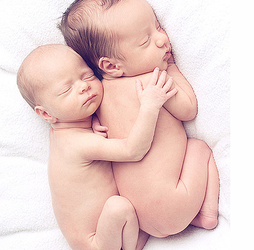twins Επιλεκτικός περιορισμός ανάπτυξης σε δίδυμη κύηση με δύο πλακούντες